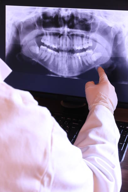 Best Emergency Tooth Extraction in Bayou Vista, LA
