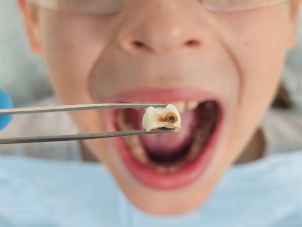 Best Walk-In Emergency Dentist in Bayou Vista, LA